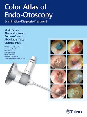 cover image of Color Atlas of Endo-Otoscopy
